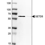 Merck Anti-SETD5 antibody produced in rabbit