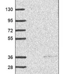 Merck Anti-KCTD6 antibody produced in rabbit