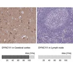 Merck Anti-DYNC1I1 antibody produced in rabbit