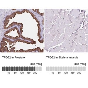 Merck Anti-TPD52 antibody produced in rabbit