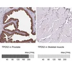 Merck Anti-TPD52 antibody produced in rabbit