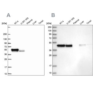 Merck Anti-RCN1 antibody produced in rabbit