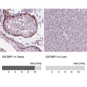 Merck Anti-IGF2BP1 antibody produced in rabbit