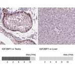 Merck Anti-IGF2BP1 antibody produced in rabbit