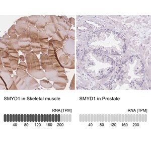 Merck Anti-SMYD1 antibody produced in rabbit
