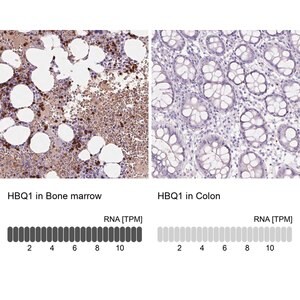 Merck Anti-HBQ1 antibody produced in rabbit