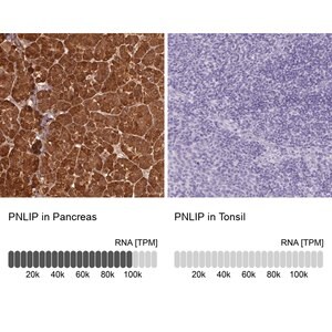 Merck Anti-PNLIP antibody produced in rabbit