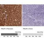 Merck Anti-PNLIP antibody produced in rabbit