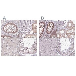 Merck Anti-RSL24D1 antibody produced in rabbit