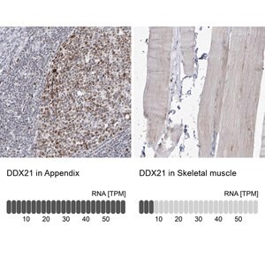 Merck Anti-DDX21 antibody produced in rabbit