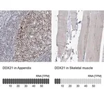 Merck Anti-DDX21 antibody produced in rabbit