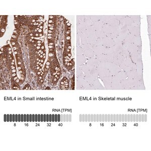 Merck Anti-EML4 antibody produced in rabbit