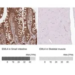 Merck Anti-EML4 antibody produced in rabbit