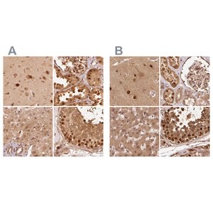 Merck Anti-PSMD1 antibody produced in rabbit