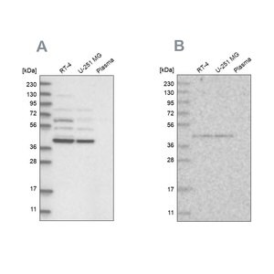 Merck Anti-GPN1 antibody produced in rabbit