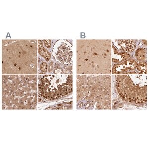 Merck Anti-PSMD1 antibody produced in rabbit
