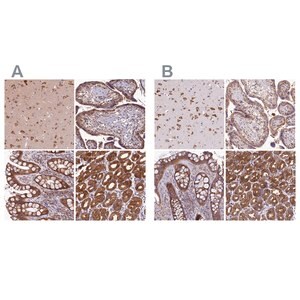 Merck Anti-QARS antibody produced in rabbit