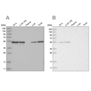 Merck Anti-RBM17 antibody produced in rabbit