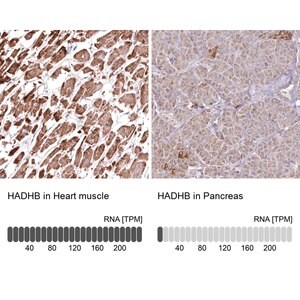 Merck Anti-HADHB antibody produced in rabbit