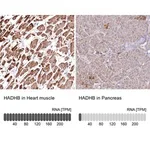 Merck Anti-HADHB antibody produced in rabbit