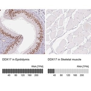 Merck Anti-DDX17 antibody produced in rabbit