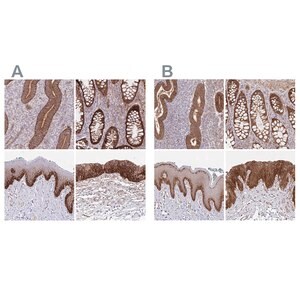 Merck Anti-ITGA2 antibody produced in rabbit