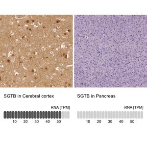 Merck Anti-SGTB antibody produced in rabbit