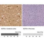 Merck Anti-SGTB antibody produced in rabbit