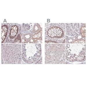 Merck Anti-RSL24D1 antibody produced in rabbit