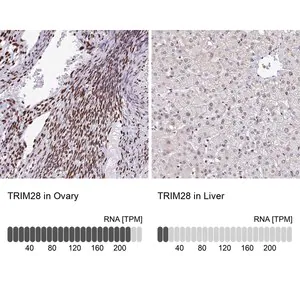 Merck Anti-TRIM28 antibody produced in rabbit