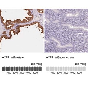 Merck Anti-ACPP antibody produced in rabbit
