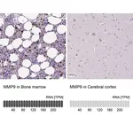 Merck Anti-MMP9 antibody produced in rabbit
