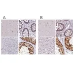 Merck Anti-CSE1L antibody produced in rabbit