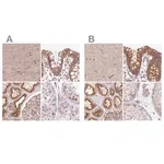 Merck Anti-HIP1R antibody produced in rabbit