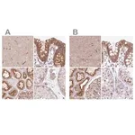 Merck Anti-HIP1R antibody produced in rabbit