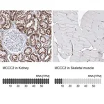 Merck Anti-MCCC2 antibody produced in rabbit