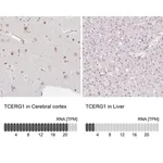 Merck Anti-TCERG1 antibody produced in rabbit