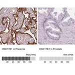 Merck Anti-HSD17B1 antibody produced in rabbit