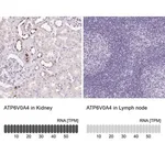 Merck Anti-ATP6V0A4 antibody produced in rabbit