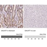 Merck Anti-GALNT7 antibody produced in rabbit