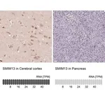 Merck Anti-SMIM13 antibody produced in rabbit