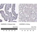 Merck Anti-ANKRD65 antibody produced in rabbit