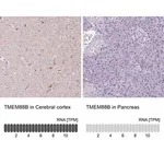 Merck Anti-TMEM88B antibody produced in rabbit