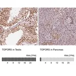 Merck Anti-TOPORS antibody produced in rabbit