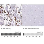 Merck Anti-PLBD1 antibody produced in rabbit