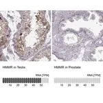 Merck Anti-HMMR antibody produced in rabbit