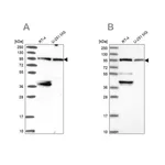 Merck Anti-UBE3A antibody produced in rabbit