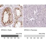 Merck Anti-KPNA2 antibody produced in rabbit