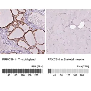 Merck Anti-PRKCSH antibody produced in rabbit