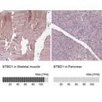 Merck Anti-BTBD1 antibody produced in rabbit